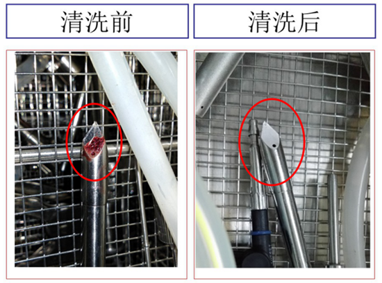 医疗植入器械的深层精密清洗解决方案