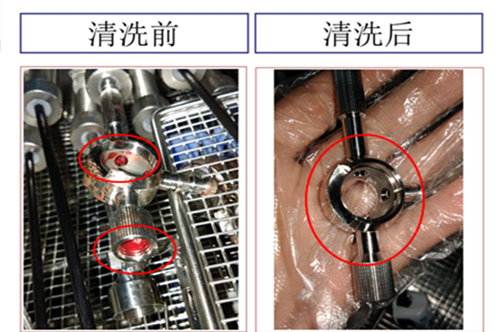 真空超声波清洗机,轻松解决医疗器械清洗难题